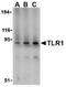 Toll Like Receptor 1 antibody, AP05596PU-N, Origene, Western Blot image 