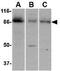 Protein Tyrosine Kinase 7 (Inactive) antibody, GTX31321, GeneTex, Western Blot image 