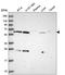 Acyl-CoA Dehydrogenase Family Member 9 antibody, HPA046720, Atlas Antibodies, Western Blot image 