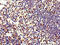 Elastase, Neutrophil Expressed antibody, LS-C369585, Lifespan Biosciences, Immunohistochemistry paraffin image 