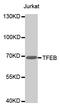 Transcription Factor EB antibody, MBS129149, MyBioSource, Western Blot image 