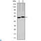 Carbonic Anhydrase 9 antibody, LS-C812519, Lifespan Biosciences, Western Blot image 