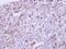 Growth Differentiation Factor 5 antibody, NBP2-16632, Novus Biologicals, Immunohistochemistry paraffin image 