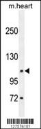 Diacylglycerol Lipase Alpha antibody, MBS9201570, MyBioSource, Western Blot image 