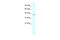 Phosphorylase Kinase Catalytic Subunit Gamma 2 antibody, 27-783, ProSci, Western Blot image 