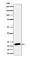 NADH:Ubiquinone Oxidoreductase Subunit B9 antibody, M08623-3, Boster Biological Technology, Western Blot image 