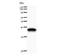 Eukaryotic Translation Initiation Factor 2 Subunit Alpha antibody, LS-C342372, Lifespan Biosciences, Western Blot image 