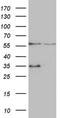Vacuolar Protein Sorting 13 Homolog B antibody, NBP2-46350, Novus Biologicals, Western Blot image 