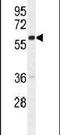 G Protein Nucleolar 3 Like antibody, PA5-24522, Invitrogen Antibodies, Western Blot image 