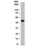 Keratin 14 antibody, 33-168, ProSci, Western Blot image 