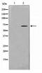 General Transcription Factor IIH Subunit 2 antibody, TA347686, Origene, Western Blot image 