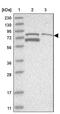 Threonyl-TRNA Synthetase 2, Mitochondrial antibody, PA5-55923, Invitrogen Antibodies, Western Blot image 