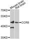 C-C chemokine receptor type 8 antibody, A8048, ABclonal Technology, Western Blot image 