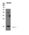 Galectin 1 antibody, STJ98716, St John