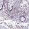 Transmembrane Serine Protease 9 antibody, HPA051483, Atlas Antibodies, Immunohistochemistry frozen image 