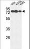 Glucuronidase Beta antibody, LS-C166747, Lifespan Biosciences, Western Blot image 