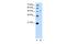 Serine Palmitoyltransferase Long Chain Base Subunit 1 antibody, PA5-42914, Invitrogen Antibodies, Western Blot image 