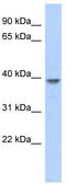 Mediator Complex Subunit 8 antibody, TA340217, Origene, Western Blot image 