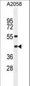 Major Histocompatibility Complex, Class I, B antibody, LS-C164911, Lifespan Biosciences, Western Blot image 