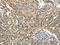 Rho Associated Coiled-Coil Containing Protein Kinase 2 antibody, CSB-PA081497, Cusabio, Immunohistochemistry paraffin image 