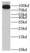 SET And MYND Domain Containing 4 antibody, FNab08050, FineTest, Western Blot image 