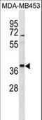 Trafficking From ER To Golgi Regulator antibody, LS-C157176, Lifespan Biosciences, Western Blot image 