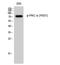 Protein Kinase C Alpha antibody, A00743Y657, Boster Biological Technology, Western Blot image 