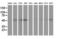 Sequestosome 1 antibody, LS-C172484, Lifespan Biosciences, Western Blot image 