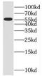 Oxysterol Binding Protein Like 2 antibody, FNab06019, FineTest, Western Blot image 