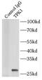 Thiamin Pyrophosphokinase 1 antibody, FNab08888, FineTest, Immunoprecipitation image 