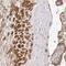 Zinc Finger CCCH-Type Containing 11A antibody, NBP1-82973, Novus Biologicals, Immunohistochemistry frozen image 
