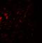 C-C Motif Chemokine Receptor 7 antibody, A00390, Boster Biological Technology, Immunofluorescence image 