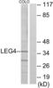 HSV antibody, LS-C119568, Lifespan Biosciences, Western Blot image 
