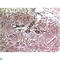 Matrix Metallopeptidase 2 antibody, LS-C813715, Lifespan Biosciences, Immunohistochemistry paraffin image 