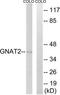 G Protein Subunit Alpha Transducin 2 antibody, TA312215, Origene, Western Blot image 