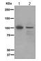 Inositol Polyphosphate-4-Phosphatase Type I A antibody, TA307584, Origene, Western Blot image 