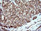 Sex Hormone Binding Globulin antibody, M00682-1, Boster Biological Technology, Immunohistochemistry paraffin image 