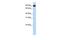 Transmembrane And Tetratricopeptide Repeat Containing 4 antibody, GTX46582, GeneTex, Western Blot image 