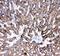 Cathepsin D antibody, LS-C313443, Lifespan Biosciences, Immunohistochemistry paraffin image 