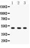 C-Terminal Binding Protein 2 antibody, PA5-79086, Invitrogen Antibodies, Western Blot image 
