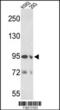 Elastin Microfibril Interfacer 1 antibody, 62-373, ProSci, Western Blot image 