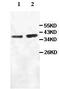 Absent In Melanoma 2 antibody, ab93015, Abcam, Western Blot image 