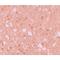 Tripartite Motif Containing 71 antibody, LS-C115887, Lifespan Biosciences, Immunohistochemistry paraffin image 