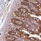 Signal Regulatory Protein Beta 2 antibody, NBP2-33512, Novus Biologicals, Immunohistochemistry frozen image 