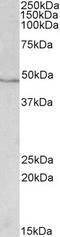 Isocitrate Dehydrogenase (NADP(+)) 1, Cytosolic antibody, EB10531, Everest Biotech, Western Blot image 