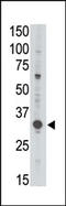 MAGE Family Member A3 antibody, AP13130PU-N, Origene, Western Blot image 