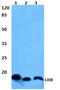 Luteinizing Hormone Beta Polypeptide antibody, A01115, Boster Biological Technology, Western Blot image 