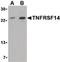 TNF Receptor Superfamily Member 14 antibody, PA5-20237, Invitrogen Antibodies, Western Blot image 