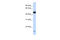 Potassium Channel Modulatory Factor 1 antibody, 25-507, ProSci, Enzyme Linked Immunosorbent Assay image 