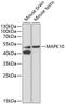 Mitogen-Activated Protein Kinase 10 antibody, 18-511, ProSci, Western Blot image 